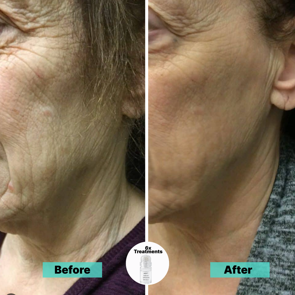 <p><strong>Why Women Are Obsessed</strong></p>