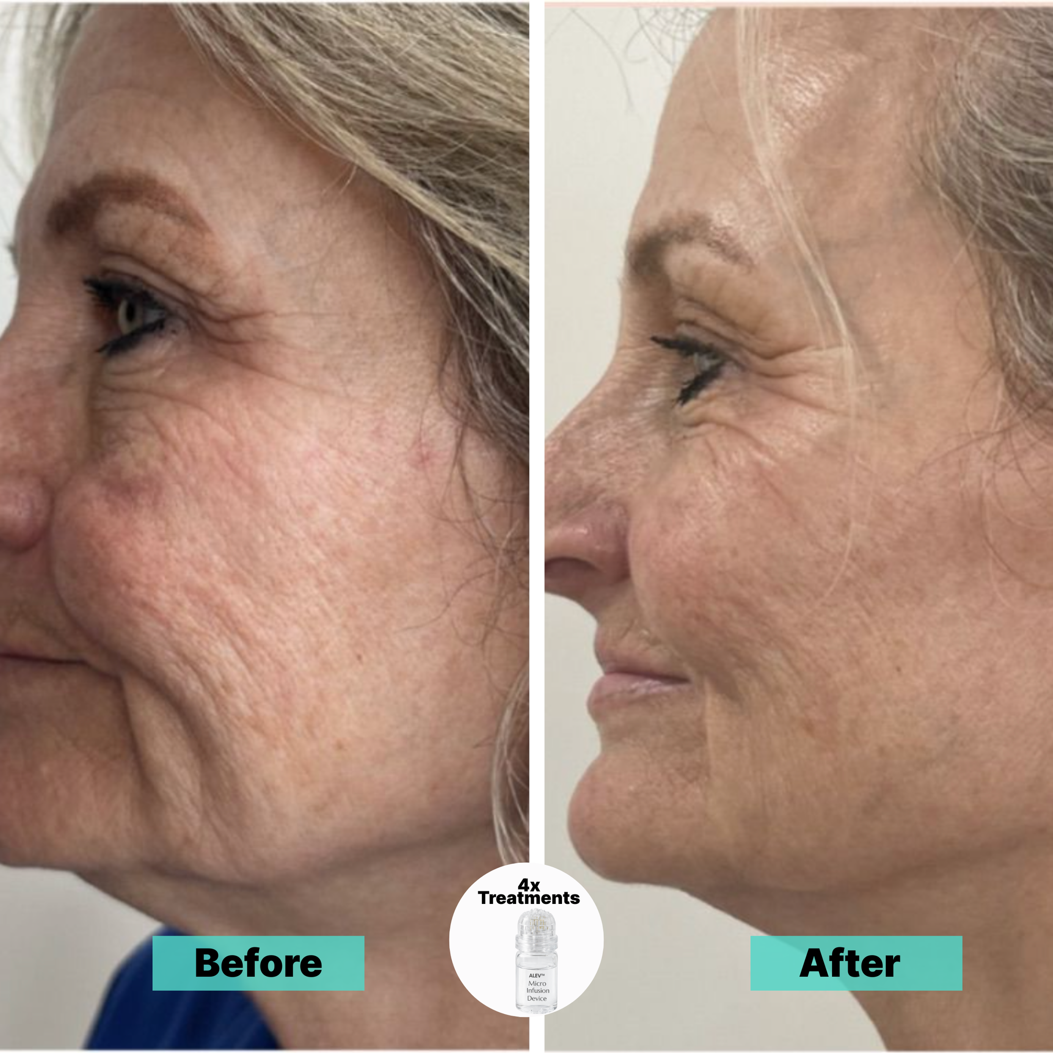 Fade dark spots and smooth wrinkles naturally