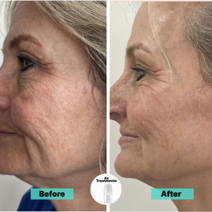 Fade dark spots and smooth wrinkles naturally