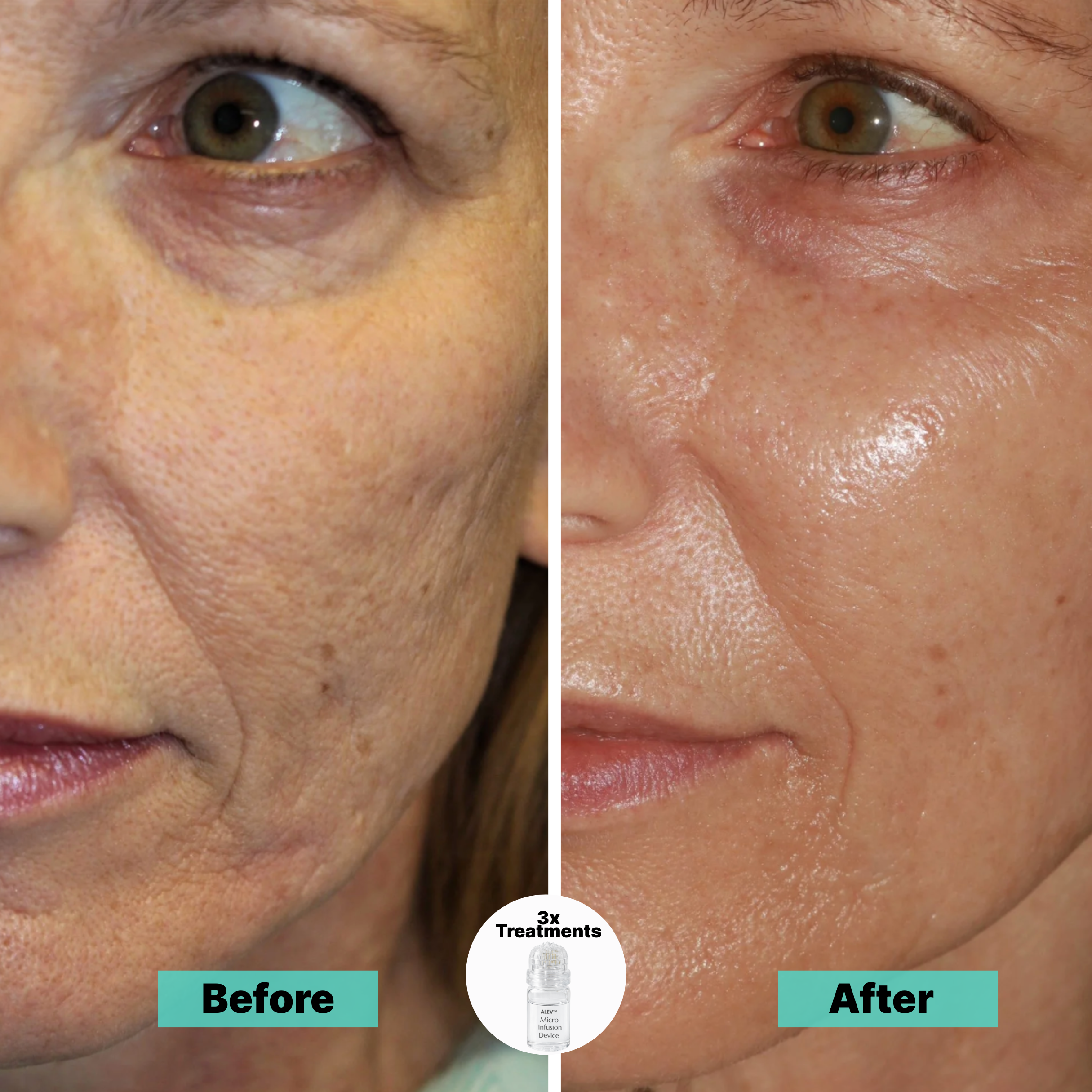 Fade dark spots and smooth wrinkles naturally