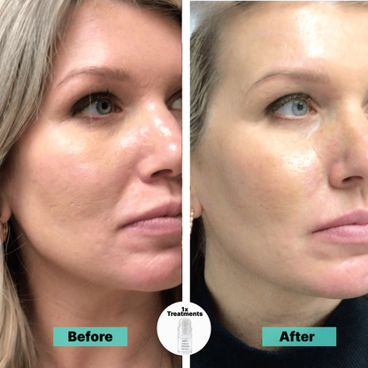 Fade dark spots and smooth wrinkles naturally