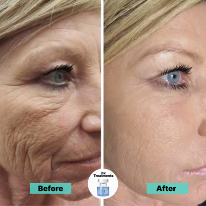 Fade dark spots and smooth wrinkles with the Micro-Infusion Facial System