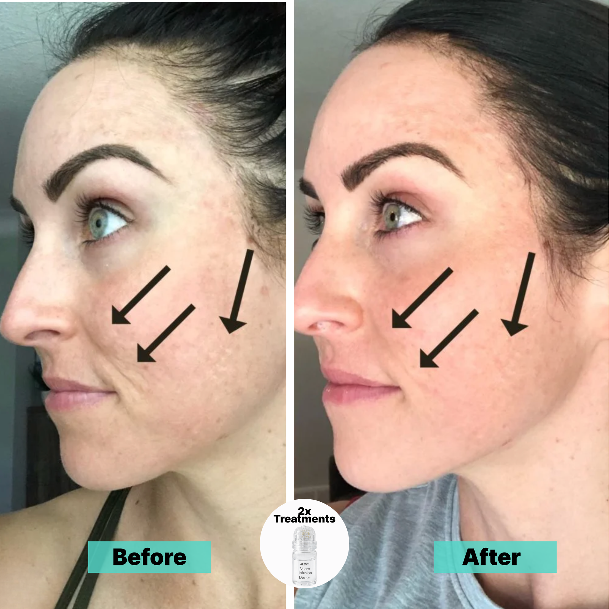 Fade dark spots and smooth wrinkles naturally