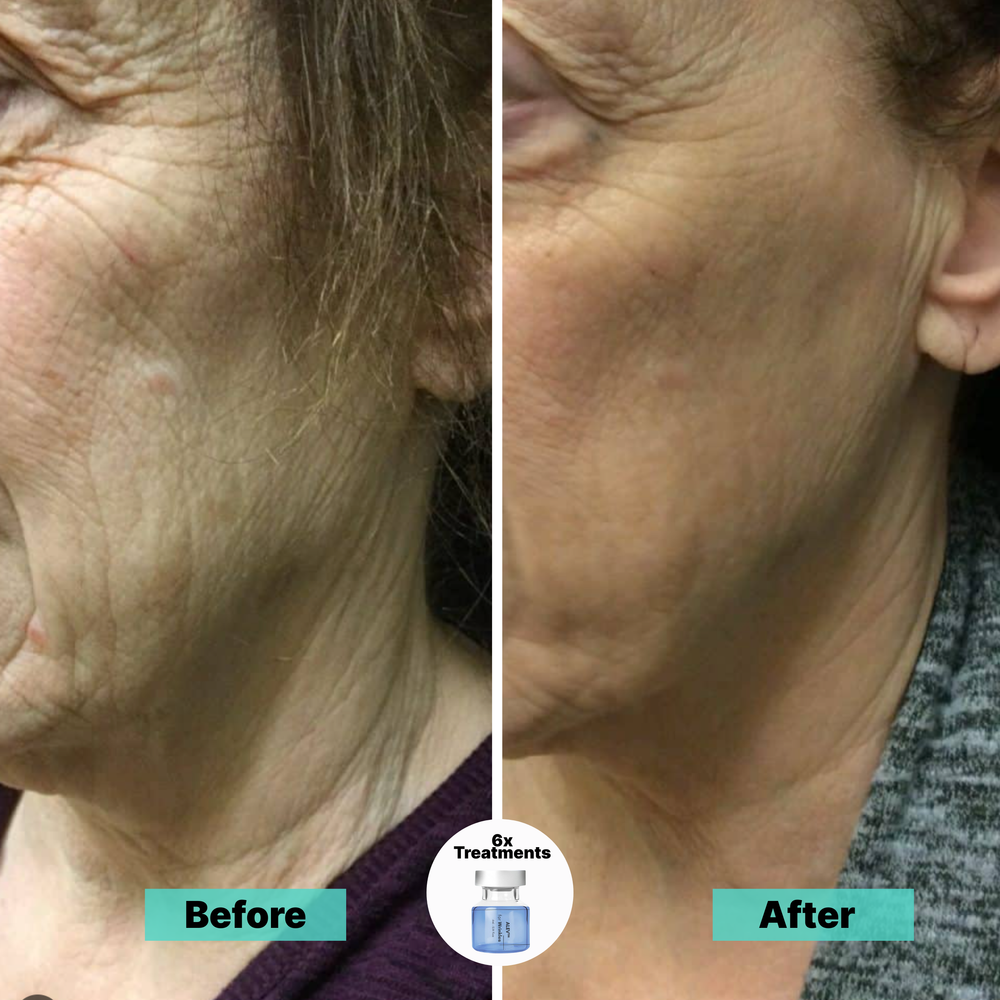 <p><strong>Why Women Are Obsessed</strong></p>