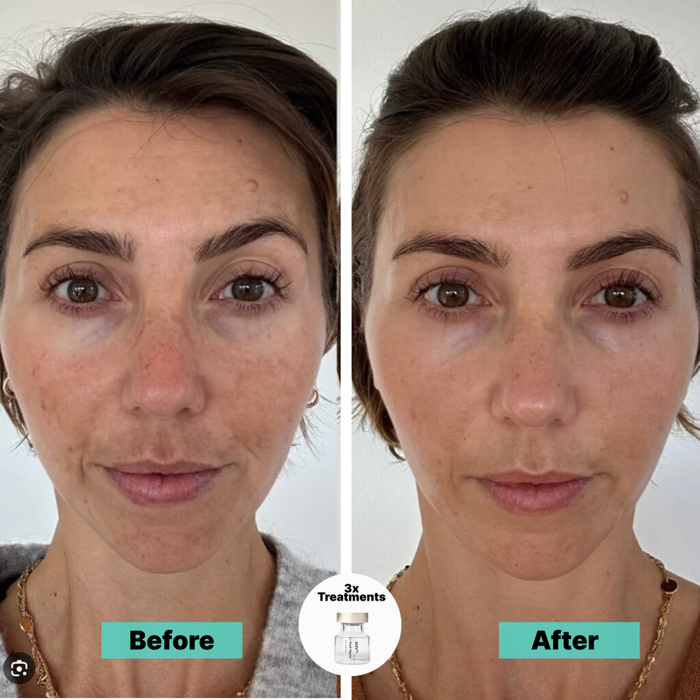 <p><strong>Why Women Are Obsessed</strong></p>