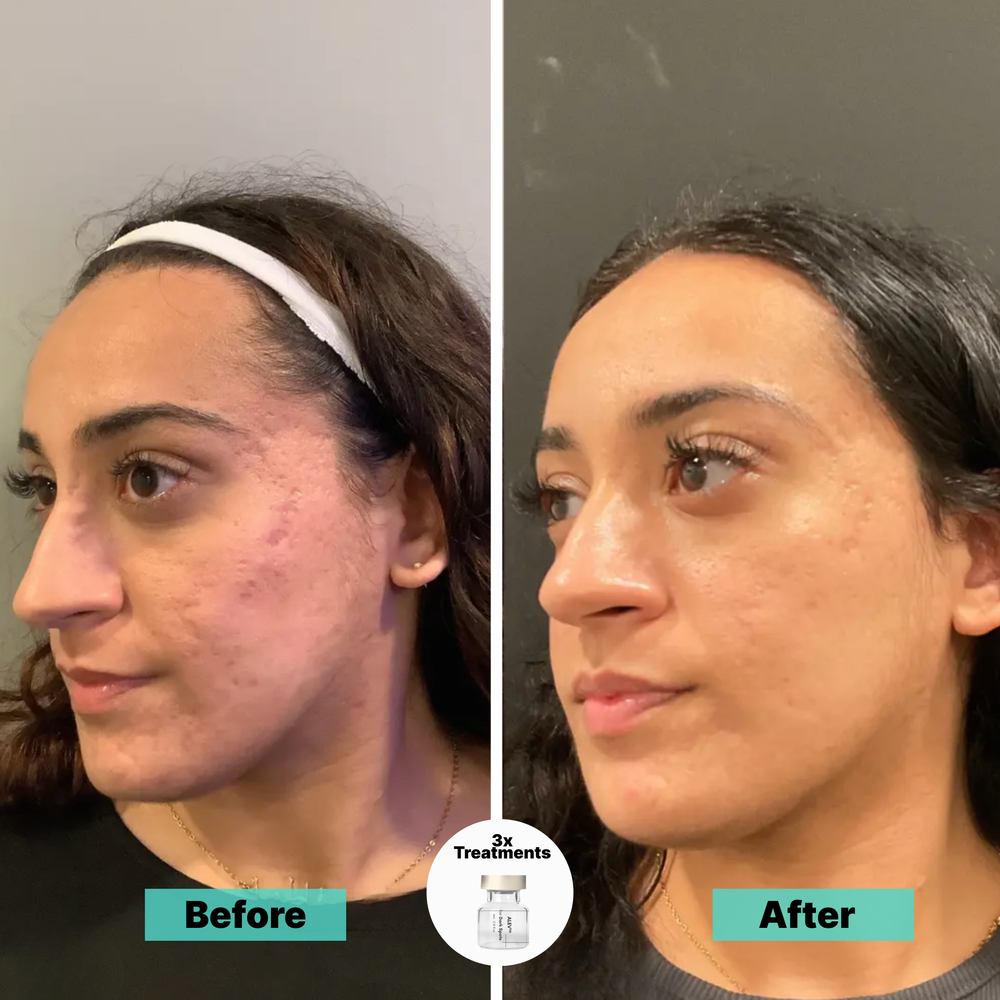 <p><strong>Why Women Are Obsessed</strong></p>