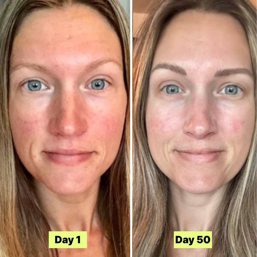 <p><strong>Why Our Customers Are Obsessed</strong></p>