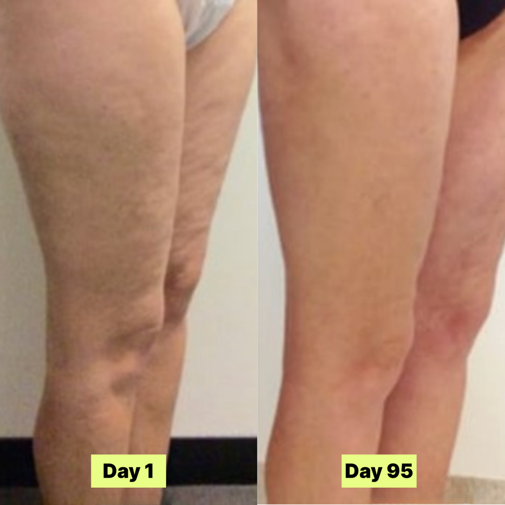 <p><strong>Why Our Customers Are Obsessed</strong></p>