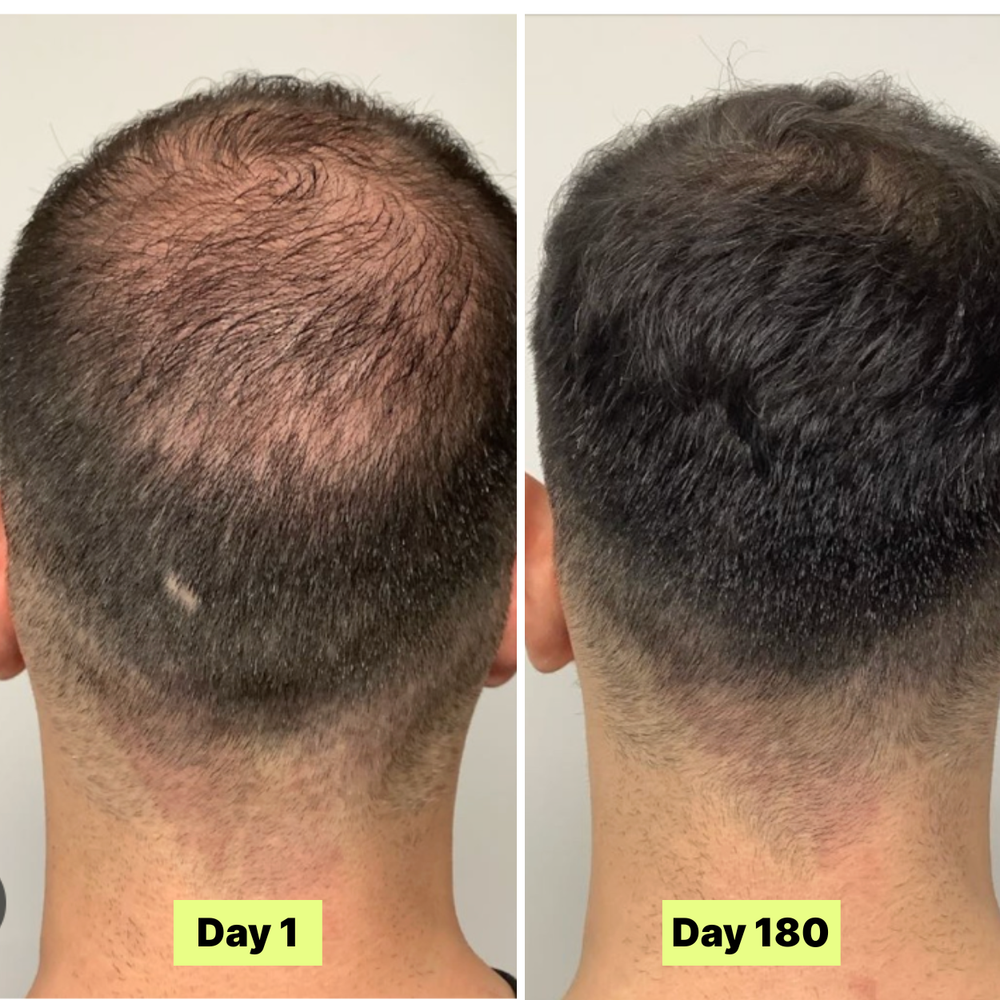 <p><strong>Why Our Customers Are Obsessed</strong></p>