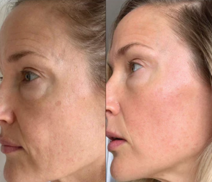 ALEV Collagen Glow Mask